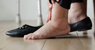 5 أطعمة تخلصك من احتباس السوائل بالجسم