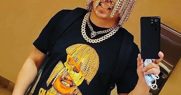 مغنى مكسيكى يستبدل شعره بسلاسل ذهب مثبتة بخطاف فى جمجمته