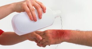 تعرف على الطريقة الصحيحة لعلاج الجروح والحروق فى المنزل