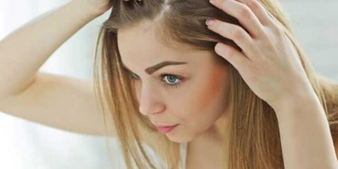 6 نصائح لحماية فروة الرأس من الجفاف والقشرة فى الشتاء