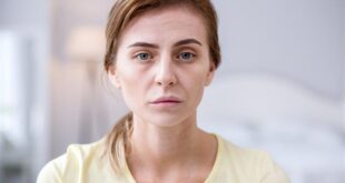 البشرة الشاحبة قد تكون من علامات الأنيميا