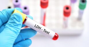 ما هو اختبار 'LDH'؟.. كل ما تريد معرفته