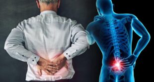متى يطلب الطبيب تصوير النخاع الشوكى؟