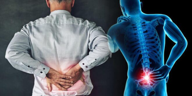 متى يطلب الطبيب تصوير النخاع الشوكى؟