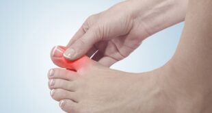 5 نصائح غذائية لتقليل ألم النقرس.. أبرزها تناول السوائل