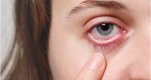 'FDA' توافق على أول قطرة عين لعلاج طول النظر