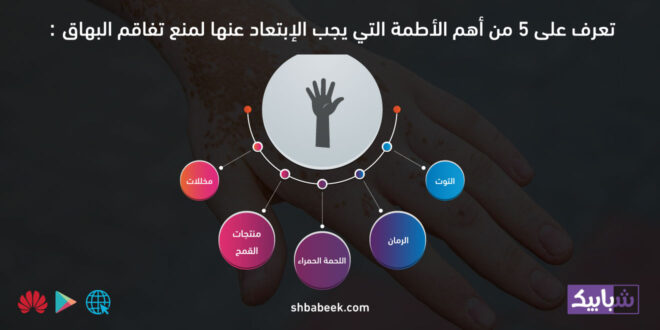تعرف على 5 من أهم الأطمة التي يجب الإبتعاد عنها لمنع تفاقم البهاق