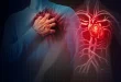 أعراضهما متشابهة ولكنهما مختلفتان تماماً.. تعرَّف على الفرق بين النوبة القلبية والسكتة القلبية