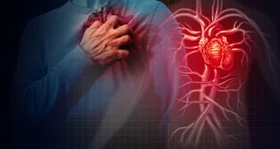 أعراضهما متشابهة ولكنهما مختلفتان تماماً.. تعرَّف على الفرق بين النوبة القلبية والسكتة القلبية