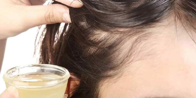 طرق الوقاية من تساقط الشعر والصلع عند السيدات