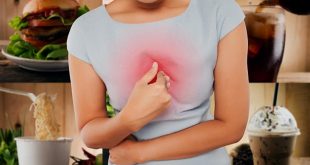 ماذا تأكل عند الشعور بالحموضة؟.. أطعمة ومشروبات لا تقربها