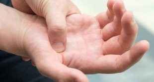 6 أسباب وراء تورم الأصابع عند الاستيقاظ