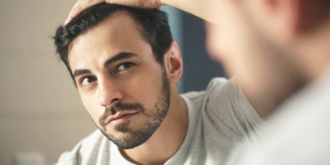 8 معتقدات شائعة ولكن خاطئة عن الصلع! تعرف اليها الان