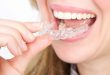 أحدث صيحات تجميل الأسنان.. كل ما ترغب في معرفته عن التقويم الشفاف قبل إجرائه
