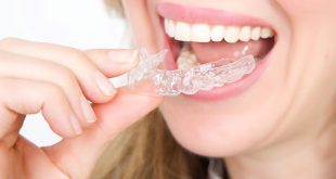 أحدث صيحات تجميل الأسنان.. كل ما ترغب في معرفته عن التقويم الشفاف قبل إجرائه