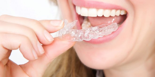 أحدث صيحات تجميل الأسنان.. كل ما ترغب في معرفته عن التقويم الشفاف قبل إجرائه