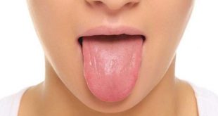 6 علامات تظهر على لسانك يمكن أن تخبرك عن صحتك