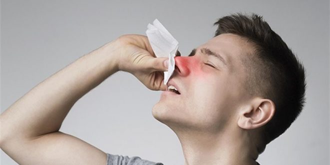 احتقان الأنف مع تغّير الفصول- كيف تتخلص منه؟