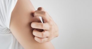 تناول هذا الفيتامين لتحمي نفسك من لدغات البعوض خلال الصيف