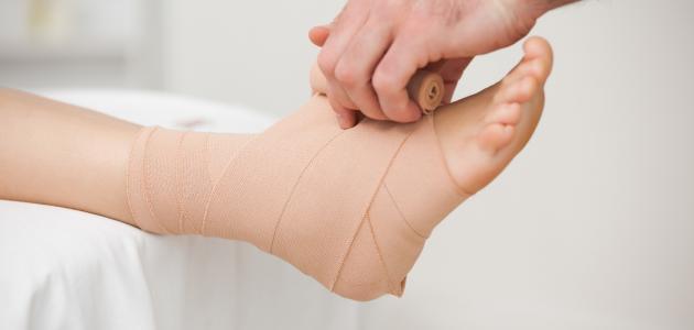 تمزق الأربطة- هل يمكن علاجه في المنزل؟