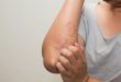علامات منذرة على الهربس بعد كورونا