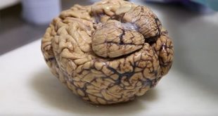 علماء يكتشفون دائرة دماغية تعزز مهارات الرياضيات لدى الأطفال