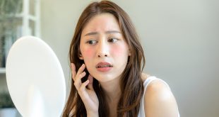 نصائح للوقاية من حروق الشمس في الصيف.. تعرف عليها