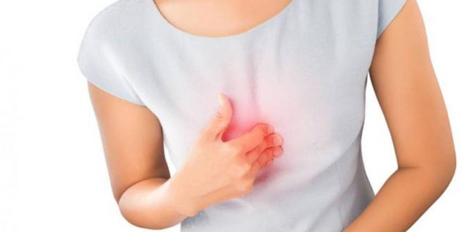 الارتجاع الحمضي للمعدة.. 5 نصائح لتخفيف الأعراض