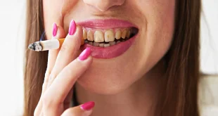5 أضرار تصيب لثتك وأسنانك بسبب التدخين.. أبرزها سرطان الفم