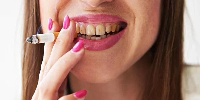 5 أضرار تصيب لثتك وأسنانك بسبب التدخين.. أبرزها سرطان الفم