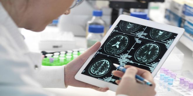 باحثون بريطانيون يطورون تقنية جديدة لتشخيص الزهايمر بسرعة ودقة