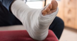 تعرف على أعراض حدوث كسر العظام