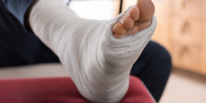 تعرف على أعراض حدوث كسر العظام