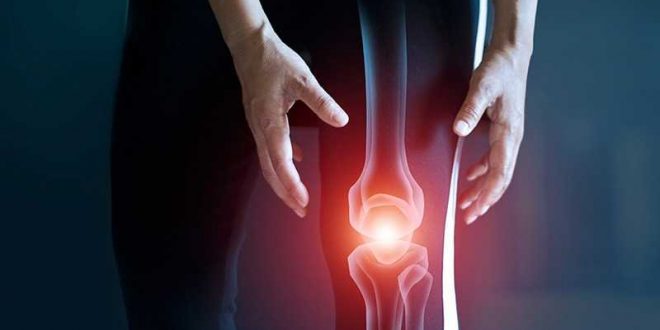 تعرف على أفضل مكمل غذائى لالتهاب المفاصل