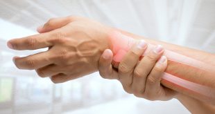 كيف يتم علاج كسر المعصم؟