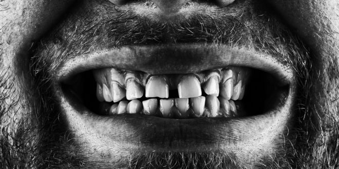 للأسنان بصمة مثل الأصابع.. كيف استطاعت الأسنان أن تحل أكثر الجرائم غموضاً؟