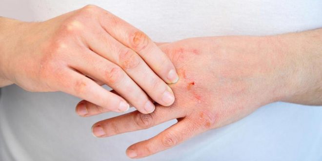 هل تشير ألوان الجلد المختلفة لمشكلات خطيرة؟