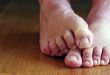 10 أفكار بسيطة للتخلص من رائحة القدم الكريهة