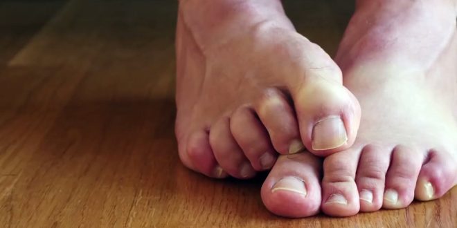 10 أفكار بسيطة للتخلص من رائحة القدم الكريهة