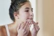5 طرق سهلة وبسيطة تساعدك على التخلص من الرؤوس البيضاء