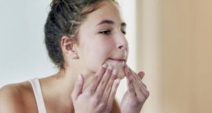 5 طرق سهلة وبسيطة تساعدك على التخلص من الرؤوس البيضاء