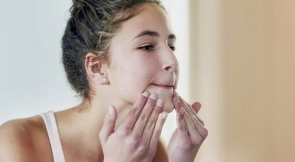 5 طرق سهلة وبسيطة تساعدك على التخلص من الرؤوس البيضاء