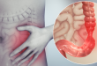 5 نصائح لصحة القولون.. منها إزالة الزوائد اللحمية قبل تطورها إلى سرطان