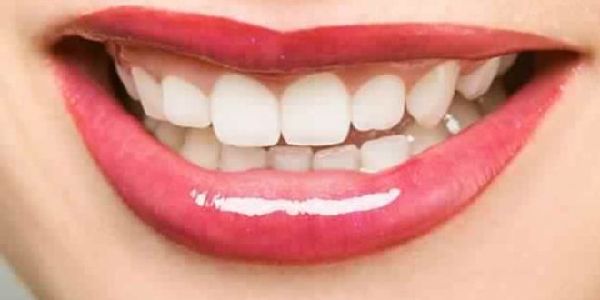 6 علامات تحذيرية لترسبات الأسنان وكيفية إزالتها