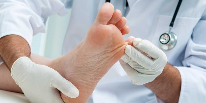 الفطريات المسببة للعدوى المميتة الأكثر خطورة صحة الإنسان
