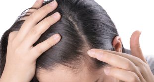 5 عادات غذائية سيئة تتسبب فى تساقط الشعر.. أبرزها نقص الحديد
