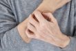 أسباب حكة الجلد ليلًا- هكذا يمكن علاجها