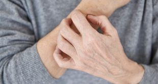 أسباب حكة الجلد ليلًا- هكذا يمكن علاجها