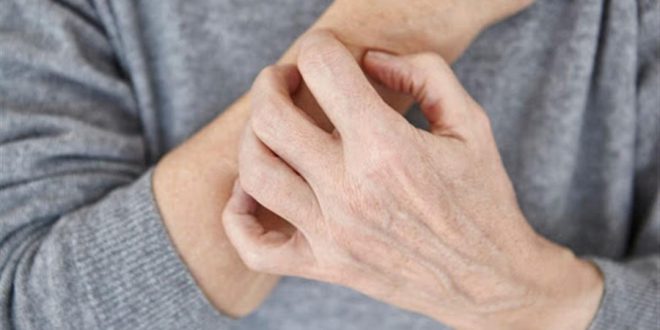 أسباب حكة الجلد ليلًا- هكذا يمكن علاجها