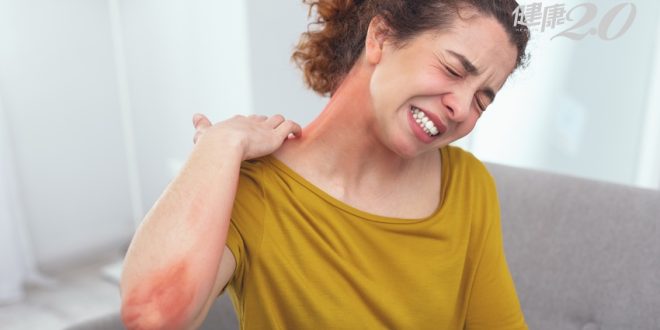 التغيرات المناخية تؤثر على جلد الإنسان وتسبب الأمراض